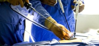 Chirurgia laparoskopowa w leczeniu insulinomy, guza hormonalnie czynnego trzustki