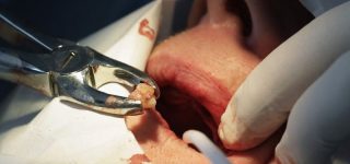 Leczenie zębów i jego wpływ na pozostałe kierunki medyczne – chronologicznie